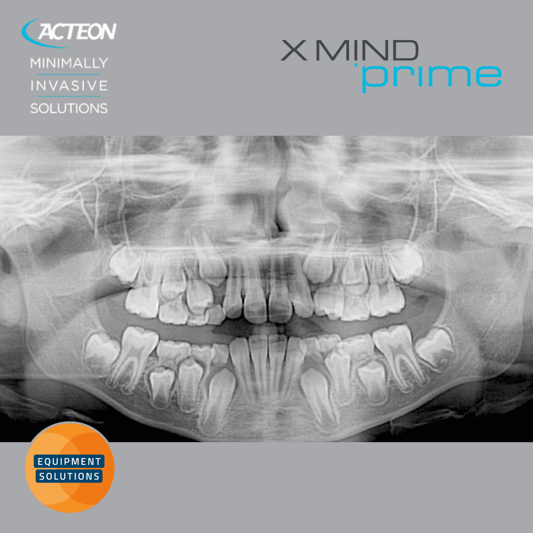 Acteon Prime 2D and 3D CBCT Dental Imaging System offers the easy to use AIS software