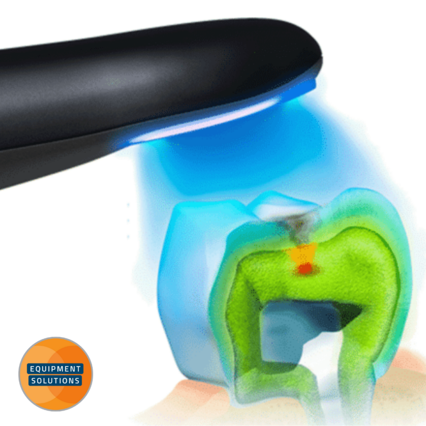 Acteon SoproLife Intraoral Camera Hague Dental Supplies Equipment