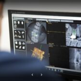 digital dentistry kea002 Digital Dental Equipment