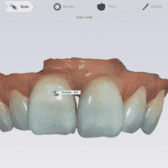 tooth shade