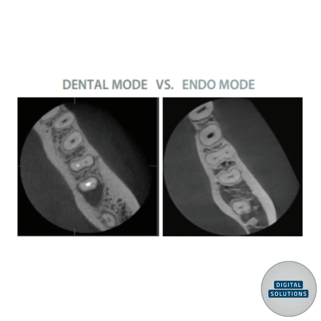 Dental vs Endo Mode Vatech Green X