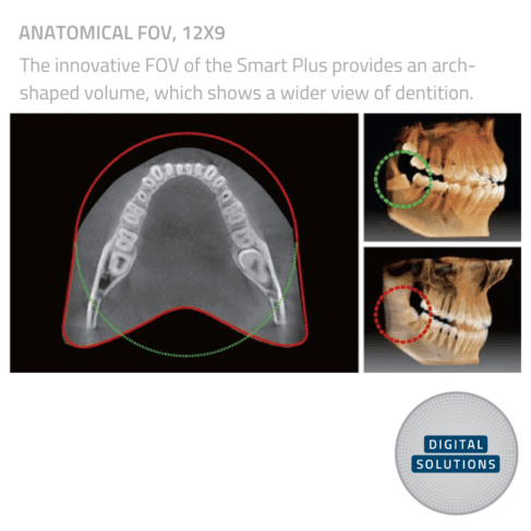 Vatech Smart Plus CBCT Unit