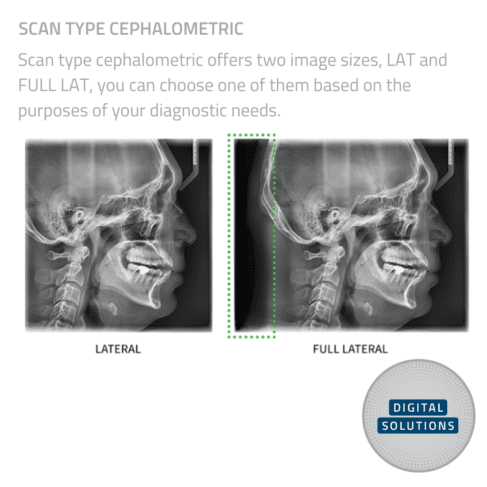 Vatech Smart Plus CBCT Unit