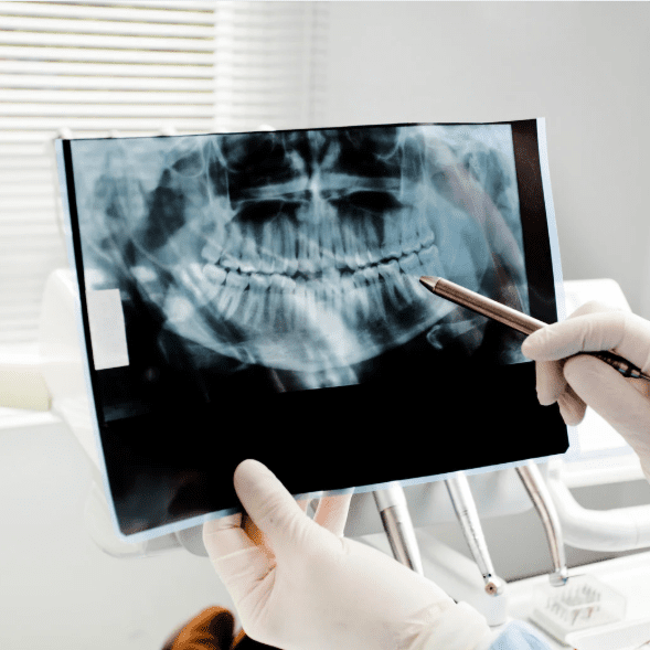 Digital dental equipment - intraoral x-ray technology